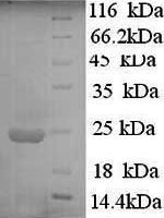 Human Interferon alpha-10 (IFNA10) Recombinant Protein, N-His - BioCrest Sci