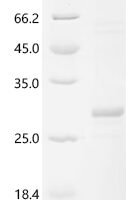 Human Thrombopoietin (THPO), partial Recombinant Protein - BioCrest Sci