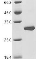 Human Hepatocyte nuclear factor 4-alpha (HNF4A), partial Recombinant Protein - BioCrest Sci