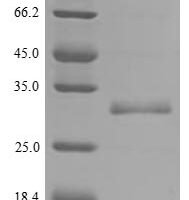 Human Valacyclovir hydrolase (BPHL) Recombinant Protein, N-His/C-Myc - BioCrest Sci