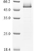 Human Serpin H1 (SERPINH1) Recombinant Protein, N-His - BioCrest Sci
