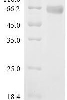 Sus scrofa CCN family member 4 (CCN4) Recombinant Protein - BioCrest Sci