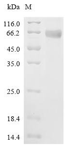 Sus scrofa CCN family member 4 (CCN4) Recombinant Protein, Sus scrofa (Pig), Mammalian cell, C-terminal 6xHis-tagged, 40.8 kDa, purity >≥ 95% as determined by SDS-PAGE.
