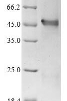Human Interferon regulatory factor 1 (IRF1) (K29R) Recombinant Protein - BioCrest Sci