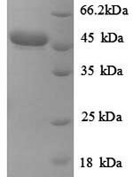 Corynebacterium efficiens Uncharacterized protein Recombinant Protein - BioCrest Sci