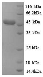 Corynebacterium efficiens Uncharacterized protein Recombinant Protein, Corynebacterium efficiens (strain DSM 44549 / YS-314 / AJ 12310 / JCM 11189 / NBRC 100395), E.coli, N-terminal GST-tagged, 48.4 kDa, purity >≥ 90% as determined by SDS-PAGE.
