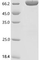 Mouse Insulin-like growth factor-binding protein complex acid labile subunit (Igfals) Recombinant Protein - BioCrest Sci