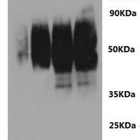 Rat Sphingosine 1-phosphate receptor 2 (S1pr2)-VLPs Recombinant Protein - BioCrest Sci