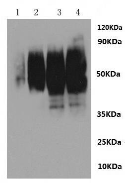 Rat Sphingosine 1-phosphate receptor 2 (S1pr2)-VLPs Recombinant Protein, Rattus norvegicus (Rat), Mammalian cell, C-terminal 10xHis-tagged(This tag can be tested only under denaturing conditions), 40.4 kDa, purity >The purity information is not available for VLPs proteins.