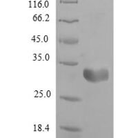 Rat Fatty acid-binding protein, heart (Fabp3) Recombinant Protein - BioCrest Sci