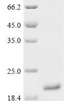 Human Lipocalin-1 (LCN1) Recombinant Protein, C-His, aa 19–176, Yeast - BioCrest Sci