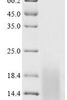Human immunodeficiency virus type 1 group M subtype C Protein Tat (tat) Recombinant Protein, N-His - BioCrest Sci