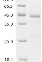 Human Eukaryotic translation initiation factor 1A, Y-chromosomal (EIF1AY) Recombinant Protein, N-GST - BioCrest Sci