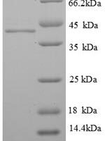 Human ELAV-like protein 2 (ELAVL2), partial Recombinant Protein, N-His, aa 4–356, E.coli - BioCrest Sci