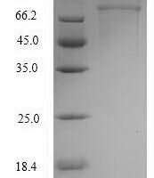 Human Clathrin interactor 1 (CLINT1) Recombinant Protein, N-His-SUMO - BioCrest Sci