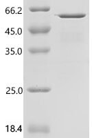 Human Max dimerization protein 1 (MXD1) Recombinant Protein - BioCrest Sci