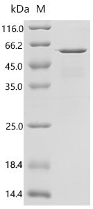 Human Max dimerization protein 1 (MXD1) Recombinant Protein, E.coli, N-terminal 10xHis-tagged and C-terminal EGFP-tagged, 54.3 kDa, purity >≥ 90% as determined by SDS-PAGE.