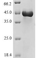 Rat Lysosomal acid lipase/cholesteryl ester hydrolase (Lipa) Recombinant Protein, N-His - BioCrest Sci