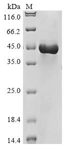 Rat Lysosomal acid lipase/cholesteryl ester hydrolase (Lipa) Recombinant Protein, N-His, Rattus norvegicus (Rat), E.coli, N-terminal 6xHis-tagged, 48.6 kDa, purity >≥ 85% as determined by SDS-PAGE.