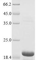 Rat Regenerating islet-derived protein 3-beta (Reg3b) Recombinant Protein, N-His-SUMOstar - BioCrest Sci