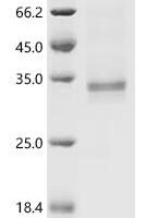 Rat Vascular endothelial growth factor D (Vegfd) Recombinant Protein, N-hFc1, aa 94–210, Purity ≥85% - BioCrest Sci
