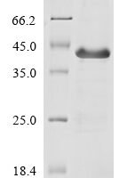 Human Interferon lambda receptor 1 (IFNLR1), partial Recombinant Protein - BioCrest Sci