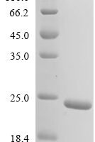 Human Mitochondrial fission 1 protein (FIS1), partial Recombinant Protein - BioCrest Sci