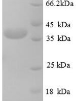 Human Testis-expressed sequence 12 protein (TEX12) Recombinant Protein - BioCrest Sci