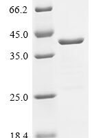Human cDNA FLJ11751 fis, clone HEMBA1005576, moderately similar to Mus musculus plexin 2 (H11Y,S17F) Recombinant Protein - BioCrest Sci
