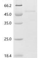 Mouse Procollagen C-endopeptidase enhancer 2 (Pcolce2) Recombinant Protein, C-10His - BioCrest Sci