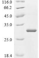 Glycine max Glycinin G1 (GY1), partial Recombinant Protein - BioCrest Sci