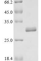 Human Aquaporin-4 (AQP4), partial, Biotinylated Recombinant Protein - BioCrest Sci