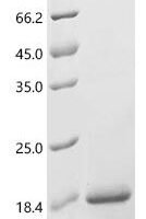 Mouse Resistin-like alpha (Retnla) Recombinant Protein - BioCrest Sci