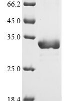 Escherichia coli O157:H7 Enoyl-[acyl-carrier-protein] reductase [NADH] FabI (fabI) Recombinant Protein - BioCrest Sci