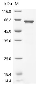 Human Signal recognition particle subunit SRP54 (SRP54) Recombinant Protein, N-10His/C-Myc, Homo sapiens (Human), E.coli, N-terminal 10xHis-tagged and C-terminal Myc-tagged, 63.2 kDa, purity >≥ 85% as determined by SDS-PAGE.