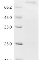 Human Protein turtle homolog A (IGSF9), partial Recombinant Protein, N-10His/C-Myc - BioCrest Sci