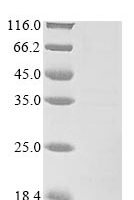 Crotalus atrox Phospholipase A2 Recombinant Protein - BioCrest Sci