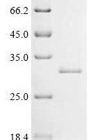 Human Transcriptional enhancer factor TEF-1 (TEAD1), partial Recombinant Protein, N-His - BioCrest Sci