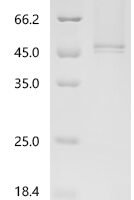 Human Cathepsin D (CTSD) Recombinant Protein - BioCrest Sci