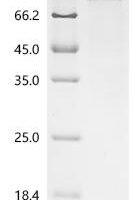 Human DNA repair protein RAD50 (RAD50), partial Recombinant Protein - BioCrest Sci
