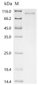 Human DNA repair protein RAD50 (RAD50), partial Recombinant Protein, Homo sapiens (Human), Homo sapiens (Human), C-terminal 6xHis-Myc-tagged, 93.8 kDa, purity >≥ 85% as determined by SDS-PAGE.