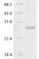 Human Adenylate kinase 7 (AK7) Recombinant Protein, C-His - BioCrest Sci