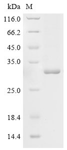 Human Adenylate kinase 7 (AK7) Recombinant Protein, C-His, Homo sapiens (Human), Yeast, C-terminal 6xHis-tagged, 83.7 kDa, purity >≥ 85% as determined by SDS-PAGE.