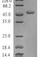 Human Troponin C, skeletal muscle (TNNC2) Recombinant Protein - BioCrest Sci