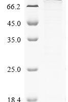 Influenza A virus Polymerase basic protein 2 (PB2) Recombinant Protein, N-10His/C-Myc, aa 1–759, Baculovirus - BioCrest Sci