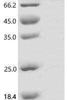 Human Protein phosphatase 1 regulatory subunit 15A (PPP1R15A), partial Recombinant Protein, C-His - BioCrest Sci
