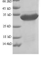 Arthrobacter globiformis Uricase (uox), partial Recombinant Protein - BioCrest Sci