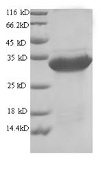 Arthrobacter globiformis Uricase (uox), partial Recombinant Protein, Arthrobacter globiformis, Yeast, N-terminal 6xHis-tagged, 34.4 kDa, purity >≥ 90% as determined by SDS-PAGE.