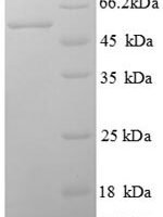 Human V-set domain-containing T-cell activation inhibitor 1 (B7H4), partial Recombinant Protein - BioCrest Sci