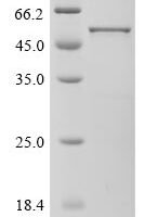 Bovine coronavirus Nucleoprotein (N) Recombinant Protein, C-His, aa 1–448, strain LY-138 - BioCrest Sci